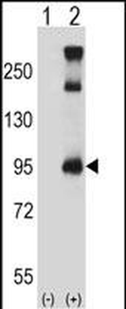 TRPC3 Antibody (C-term)