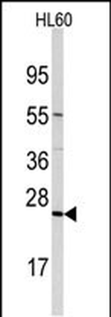 TRAPPC4 Antibody (N-term)