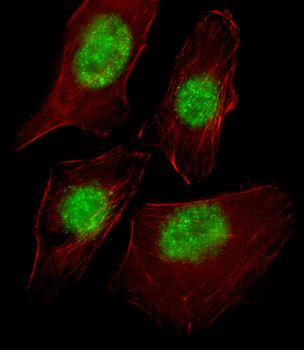 TAF9 Antibody (N-term)