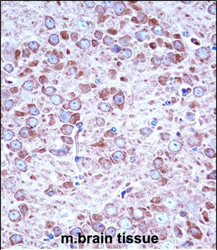 Mouse Aak1 Antibody (Center)