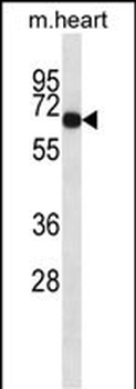 Mouse Adck1 Antibody (C-term)