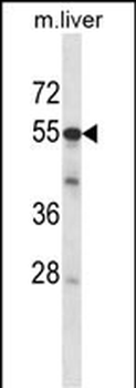 Mouse Adck2 Antibody (Center)