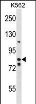 BACH2 Antibody (Center)