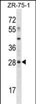 MSX2 Antibody (Center)