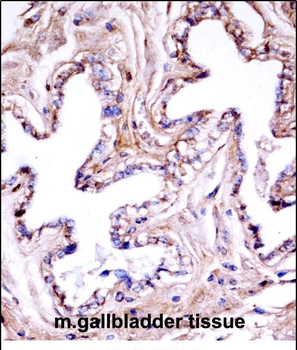 Mouse Akt1 Antibody (N-term)