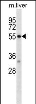 Mouse Dapk2 Antibody (N-term)