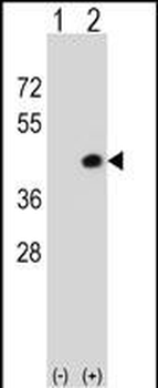 Mouse Dapk2 Antibody (N-term)