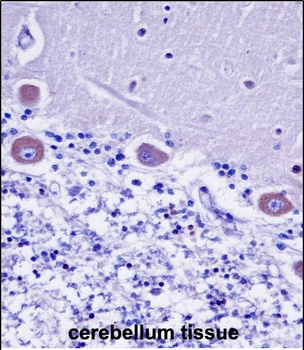 KDELR2 Antibody (C-term)