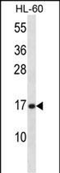 PLA2G5 Antibody (C-term)
