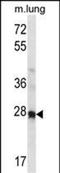 Mouse Hoxa4 Antibody (N-term)