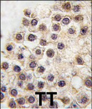 BDP (ARID3B) Antibody (C-term)