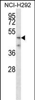 TMPRSS5 Antibody (N-term)