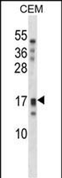 KLK15 Antibody (Center)