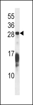 RAP1B Antibody (C-term)