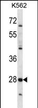 PRSS27 Antibody (C-term)