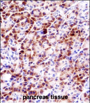 PRSS27 Antibody (C-term)