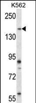 Mouse Sgk269 Antibody (Center)