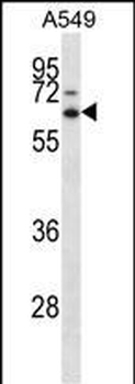 ZSCAN22 Antibody (Center)
