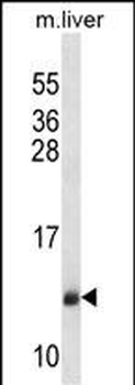 SEC61B Antibody (Center)