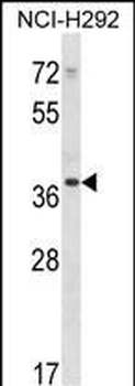 PDLIM1 Antibody (C-term)