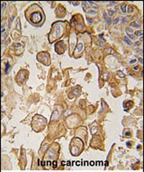 Mouse TLR6 Antibody (C-term)