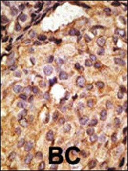 Mouse TLR6 Antibody (C-term)