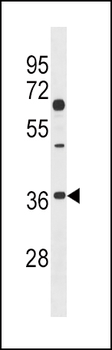 DKK2 Antibody (C-term)