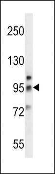Metabotropic Glutamate Receptor 6 (GPRC1F) Antibody (C-term)