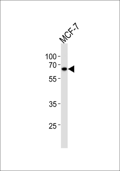 ESR2 Antibody (Center)