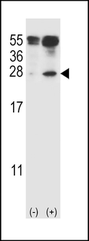 IL-17D Antibody (Center)