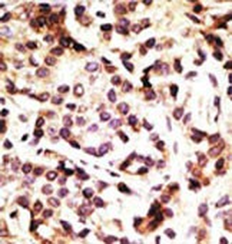 Beclin 1 Antibody
