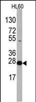 EIF4E Antibody (N-term)