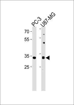 JUN Antibody (S63)