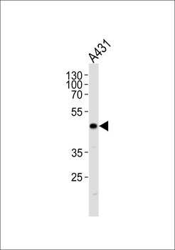 JUN Antibody (T243)