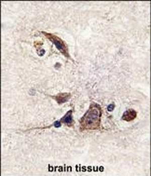 JUN Antibody (T243)