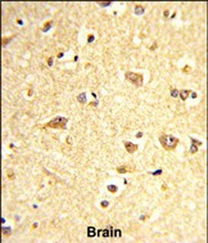 SOX4 Antibody (Center)