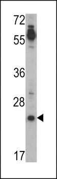 CRIPTO (TDGF1) Antibody (N-term)