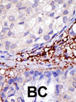 TRIAD3 (UBCE7IP1) Antibody (C-term)