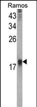 UBE2B Antibody (C-term)