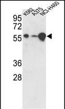 USP3 Antibody (C-term)