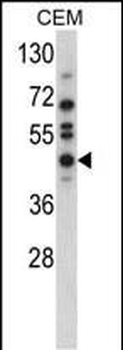 USP12 Antibody (N-term)