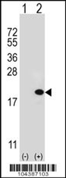 UBE2V1 Antibody (C-term)