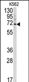 Ubiquilin3 Antibody (N-term)