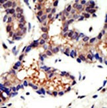 Ubiquilin3 Antibody (N-term)