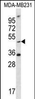 TPST1 Antibody (C-term)