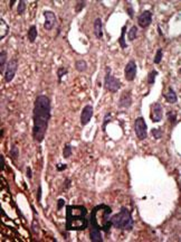 FNTB Antibody (N-term)