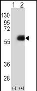 NMT2 Antibody (N-term)