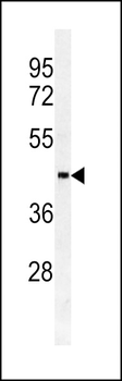 SULT2B1a/b Antibody (N-term)