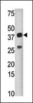 SULT1C2 Antibody (N-term)