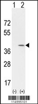 CCND1 Antibody (Center)